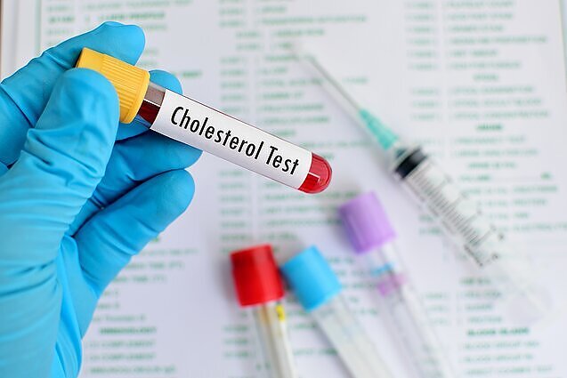 Kova su „bloguoju“ cholesteroliu: gydytoja atsakė, kam profilaktiškai tikrintis būtina