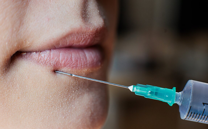 Žinios. Siekiant užkardyti nelegalias invazines grožio procedūras, siūloma jas leisti atlikti gydytojams