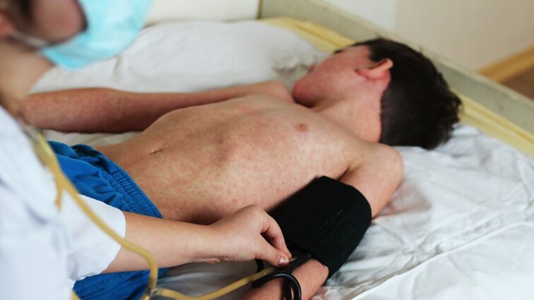 PSO skelbia apie tymų protrūkį Europoje: praėjusiais metais susirgimų skaičius išaugo 30 kartų