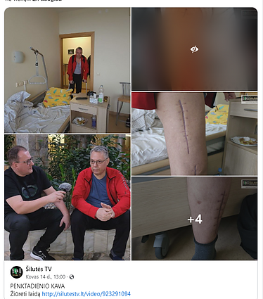 Vaidas Bendaravičius apie savo sveikatos būklę papasakojo ir Šilutės televizijai