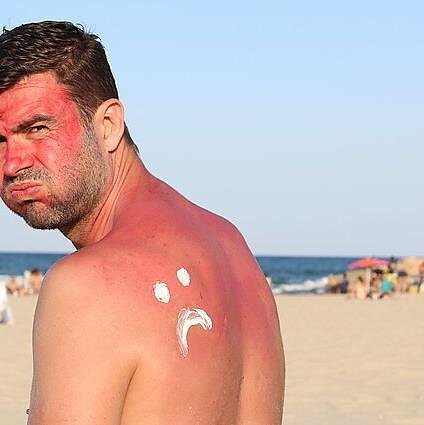 Gydytoja dermatologė apie pavasarinę saulę: kremas nuo saulės nepamaišys ir apniukusią dieną