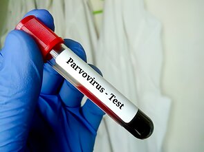 Parvovirusas