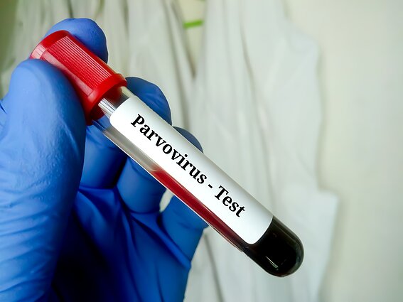 Parvovirusas