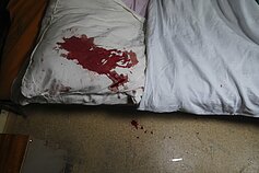 Apšaudyta Charkivo ligoninė Apšaudyta Charkivo ligoninė