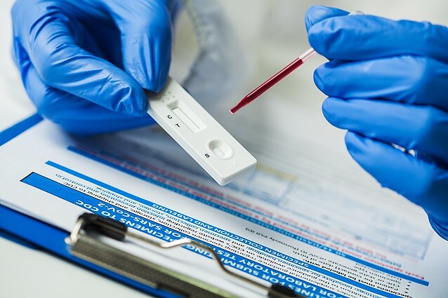 Prekybos vietose daugėja greitųjų testų: medikai ragina neužsiimti savigyda