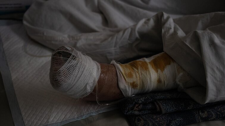 Aptarė Ukrainoje kojos netekusio lietuvio būklę: pavojus gyvybei negresia