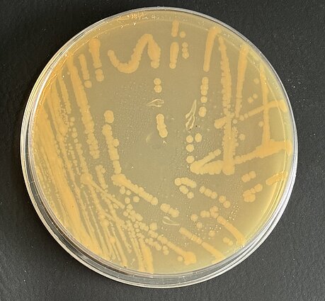Petri lėkštelė su E.coli bakterijomis