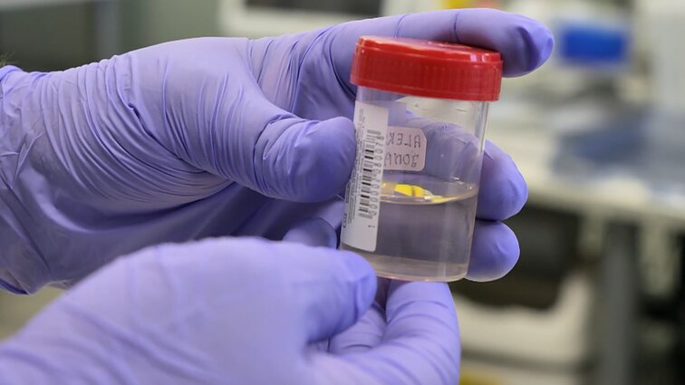 Šlapimo tyrimų svarbą aptarusi gydytoja: vien iš spalvos yra pavykę nustatyti lėtinę ligą