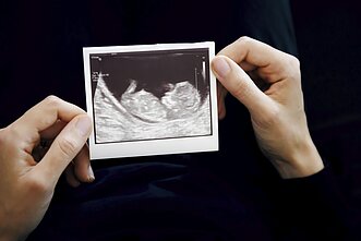 Nėštumas (asociatyvi nuotr.) Nėštumas (asociatyvi nuotr.)