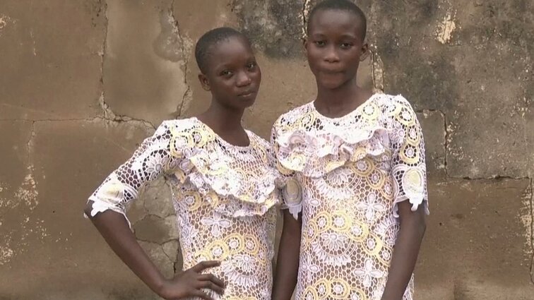 Nigerijos mįslė: kodėl čia gimsta neįprastai daug dvynių?