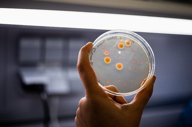 Ukrainoj auga mirtingumas nuo infekcijų, kurias sukelia antibiotikams atsparios bakterijos