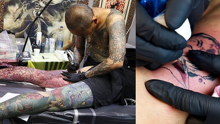 Tamsioji tatuiruočių pusė: kur keliauja dažai ir ką chirurgai randa operuodami pacientus?