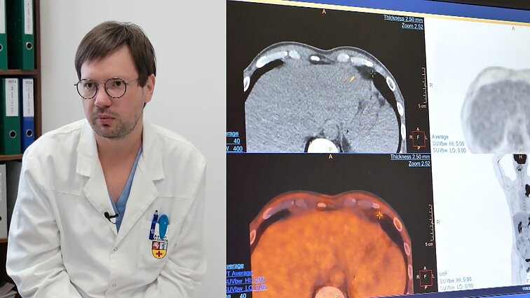 Donoriniai kraujo vėžio gydymo būdai – šiuolaikinis stebuklas: ką dar žada mokslas?