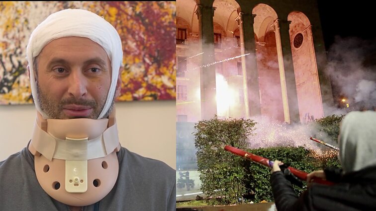 Sakartvele policijos sužeistas Guramas: stebuklas, kad galiu judinti rankas ir kalbėti