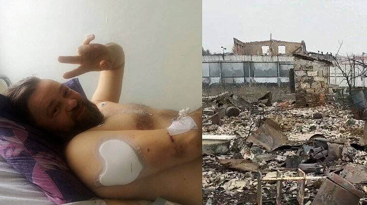 Po rusų drono atakos išgyvenęs Osvaldas: kariai netiki paliaubomis