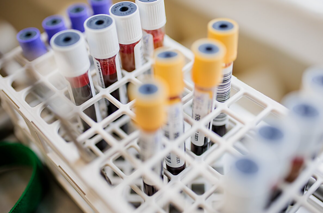 Vilniaus universitete atidaromas pirmasis šalyje populiacinis biobankas