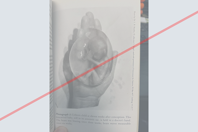 Internete plinta klaidinanti informacija apie nėštumo nutraukimą Internete plinta klaidinanti informacija apie nėštumo nutraukimą