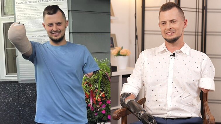 Rankas atėmusį incidentą prisiminęs Matas: nenoriu, kad kiti manęs gailėtų