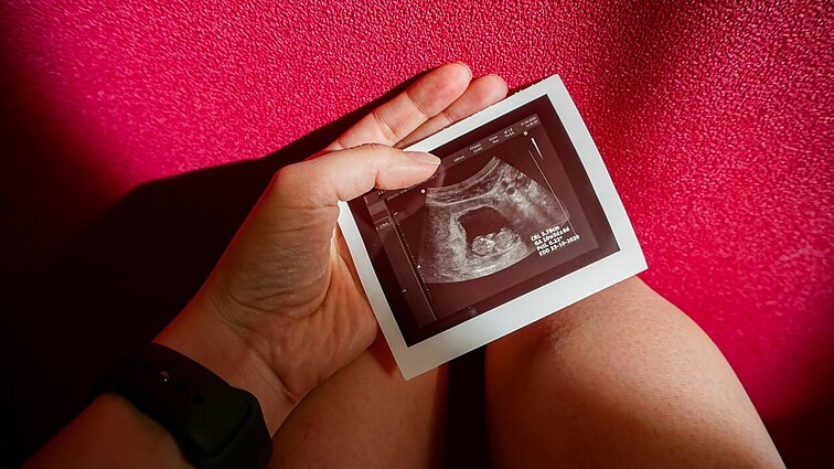 Besitęsianti demografinė krizė Lietuvoje: daliai porų nevaisingumo gydymas – neprieinamas