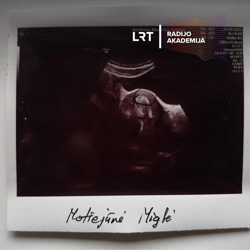 MIglės motiejūnės nuotr., Beveik mama