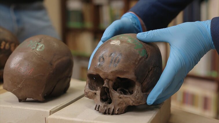 Mokslinė sensacija – rastos kaukolės, kurioms yra 11 tūkst. metų