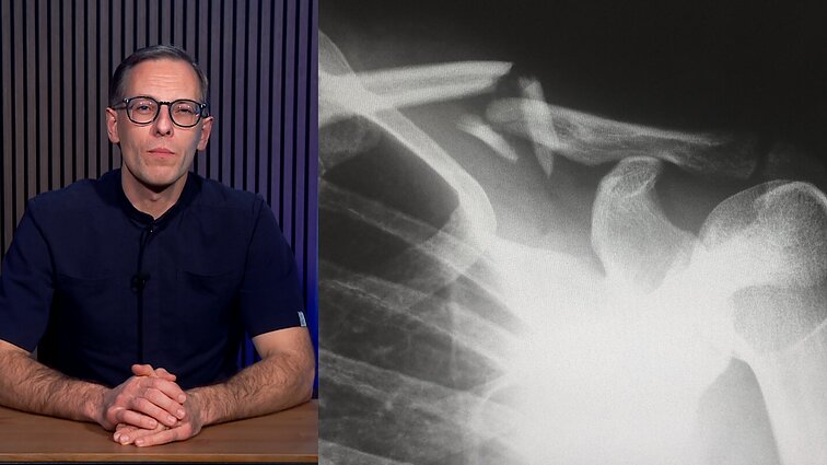 Vonią traumų šaltiniu laikantis gydytojas: blogas žingsnis ir gyvenimas sutrumpėja 10 metų