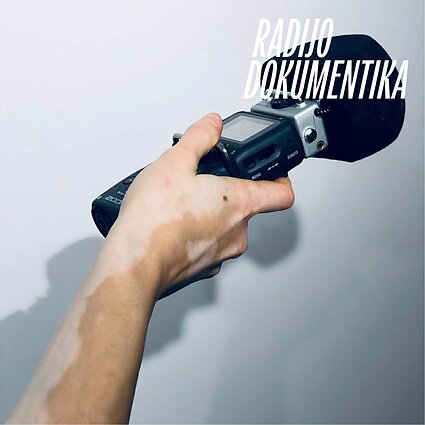 Matau jų žvilgsnius ir galvoju, ar taip bus visada