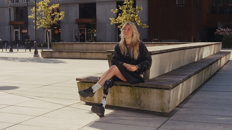 Svajonės tapti modeliu neatsisakiusi Indrė: 20 metų slėpiau savo negalią