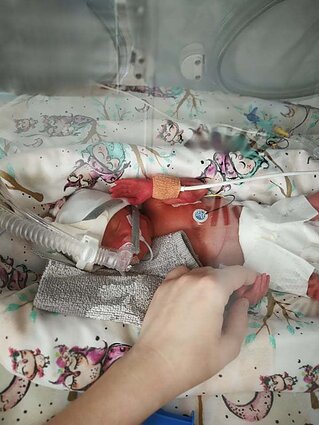 Elija gimė 27-ą nėštumo savaitę 1010 gramų svorio 