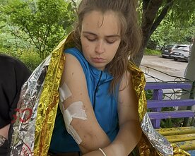 Stebuklingai išsigelbėjusi Oleksandra Kopycina rodė patirtus sužeidimus Stebuklingai išsigelbėjusi Oleksandra Kopycina rodė patirtus sužeidimus