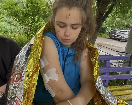 Stebuklingai išsigelbėjusi Oleksandra Kopycina rodė patirtus sužeidimus Stebuklingai išsigelbėjusi Oleksandra Kopycina rodė patirtus sužeidimus