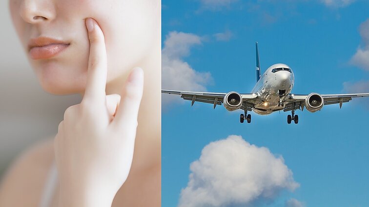UV spinduliuotė – kur kas didesnė: paaiškino, kaip skrydžiai atsiliepia mūsų odai