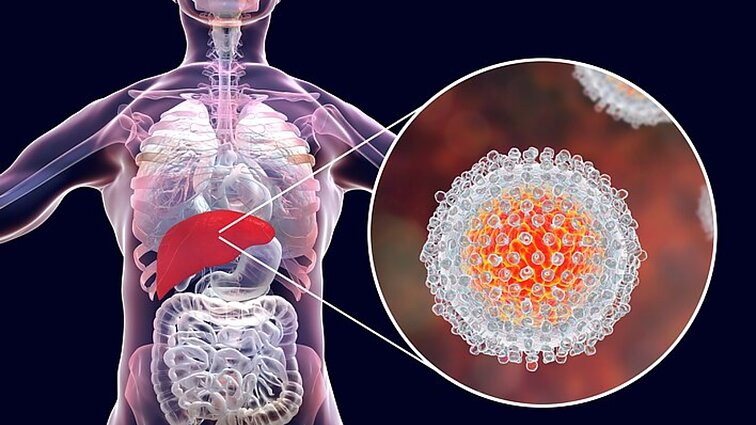 Lietuvos kova su hepatitu C įvertinta pasaulyje: profesoriui skirtas apdovanojimas